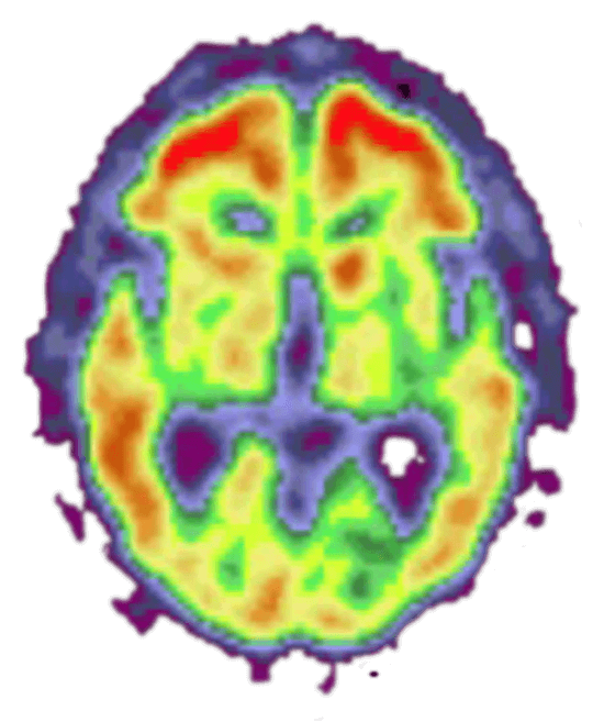 Photo of brain